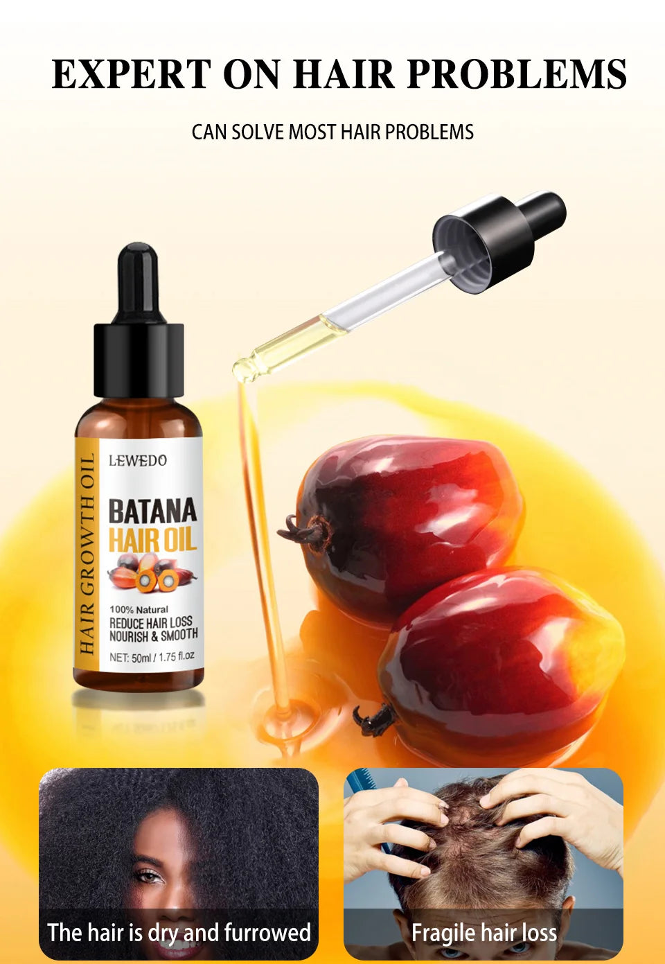 Batana Oil Africa Women Traction Alopecia Treatment Batana Hair Spray 100% Natural Hair Regrowth Hair Loss Crazy Fast Growth Oil