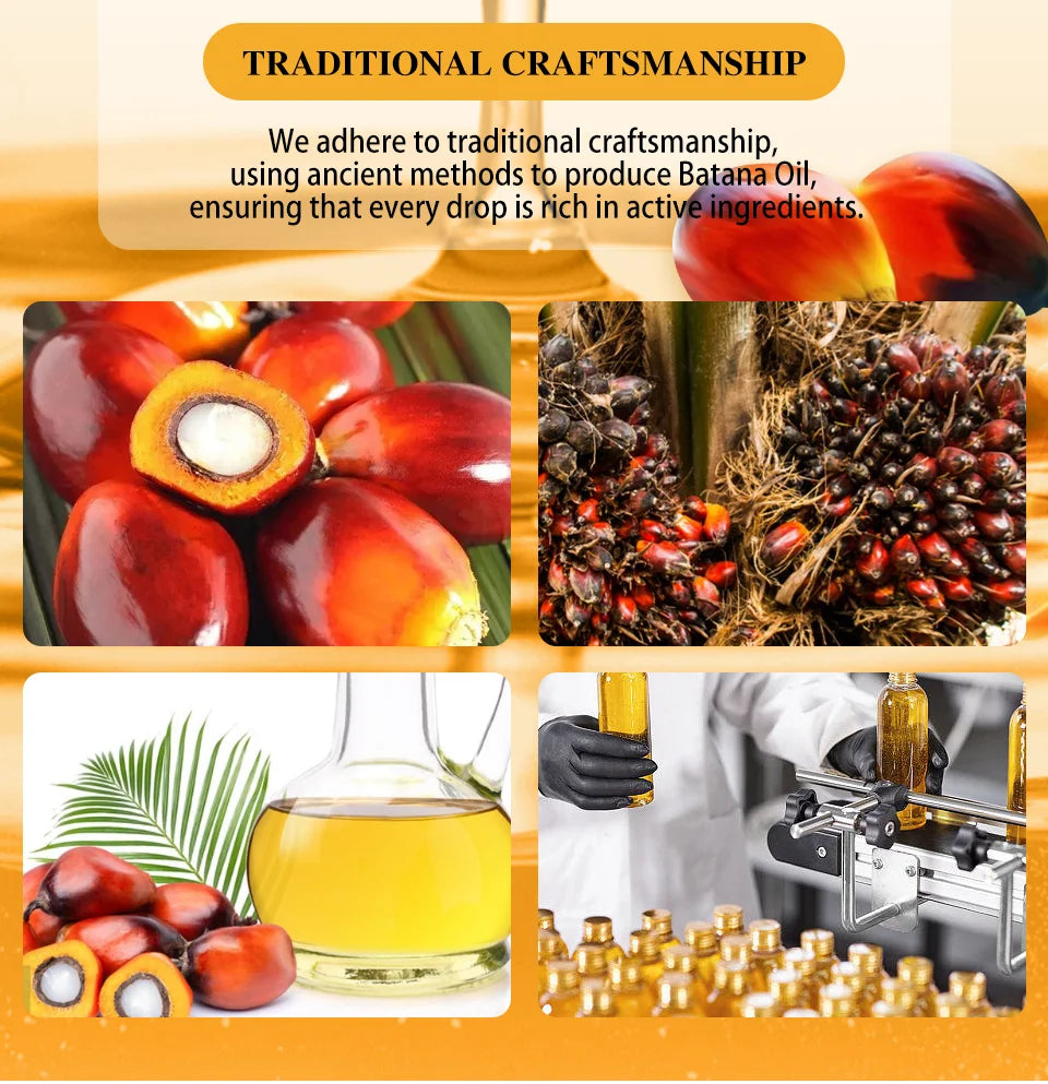 Batana Oil Africa Women Traction Alopecia Treatment Batana Hair Spray 100% Natural Hair Regrowth Hair Loss Crazy Fast Growth Oil