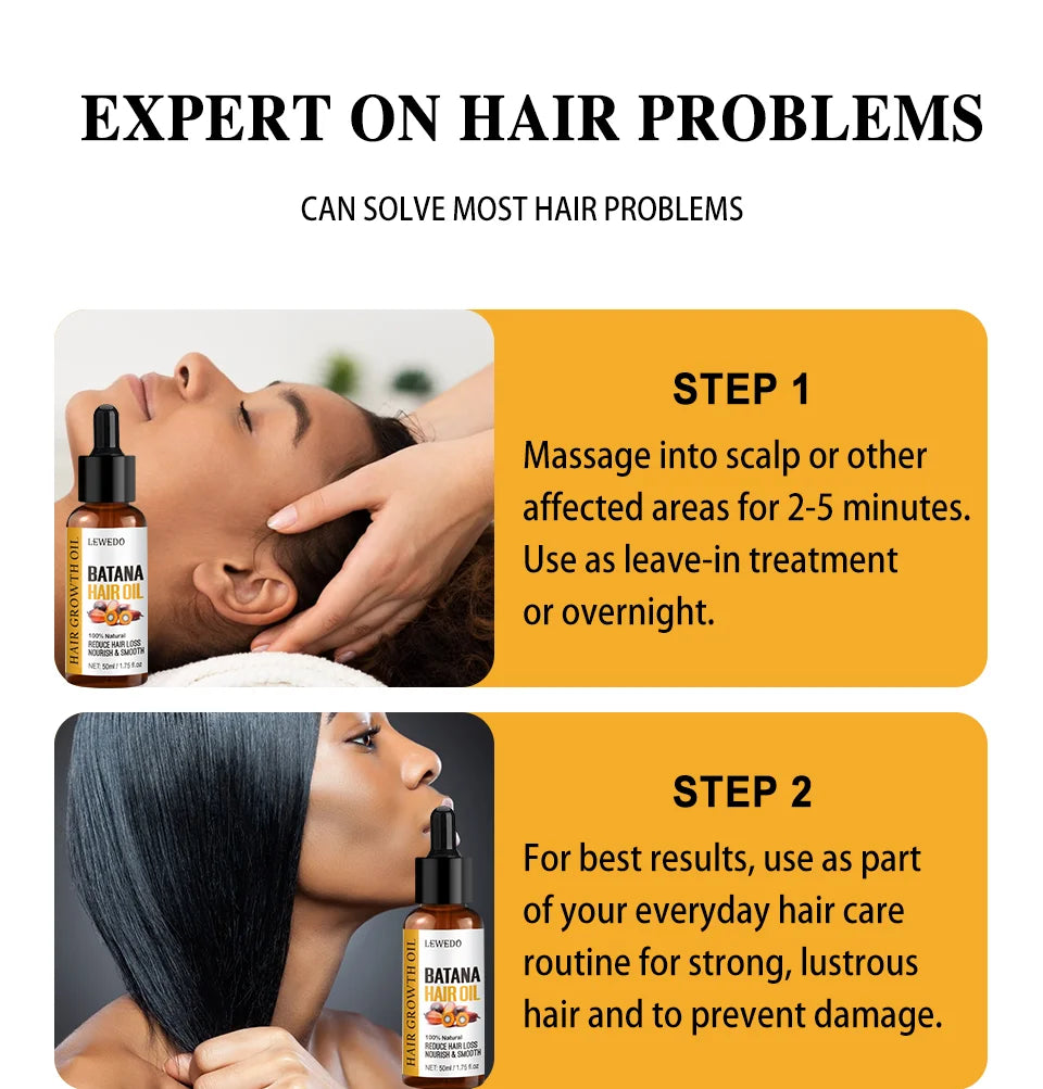 Batana Oil Africa Women Traction Alopecia Treatment Batana Hair Spray 100% Natural Hair Regrowth Hair Loss Crazy Fast Growth Oil